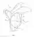 Fig. 03 - Circular glenoid method for shoulder arthroplasty