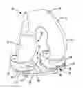 Fig. 01 - Knee prosthesis