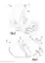 Fig. 03 - Knee prosthesis
