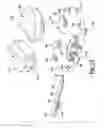 Fig. 12 - Knee prosthesis