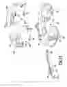Fig. 13 - Knee prosthesis