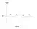 Fig. 09 - Variable step tracking