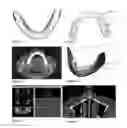 Fig. 02 - Method for (semi-) automatic dental implant planning