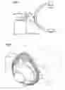 Fig. 02 - SCALE-INDICATING DEVICE AND C-ARM X-RAY MACHINE