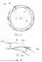 Fig. 07 - ECCENTRIC DUAL ROTOR ASSEMBLY FOR WIND POWER GENERATION