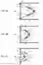 Fig. 04 - Stroboscopic device