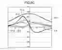 Fig. 09 - Optical disc device