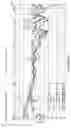 Fig. 06 - Earmuff enclosure