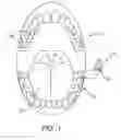 Fig. 02 - MICROPHONE PLACEMENT FOR ORAL APPLICATIONS