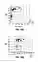 Fig. 09 - System and method for detection of acoustic shadows and automatic assessment of image usability in 3D ultrasound images
