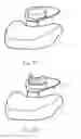 Fig. 04 - Odontological imaging apparatus