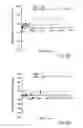 Fig. 10 - Method and system for plaque characterization