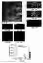 Fig. 07 - Quantifying cell death