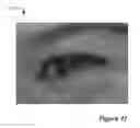 Fig. 19 - Red-eye removal using multiple recognition channels