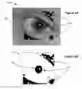 Fig. 11 - Red-eye removal using multiple recognition channels