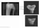 Fig. 01 - Black bear parathyroid hormone and methods of using black bear parathyroid hormone