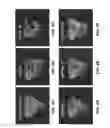 Fig. 10 - Black bear parathyroid hormone and methods of using black bear parathyroid hormone