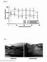 Fig. 03 - BIOMARKER OF ALLERGIC DISEASE AND USE OF THE SAME