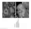 Fig. 09 - HUMAN TYPE I TASTE RECEPTOR SUBUNIT 3 MODULATORS AND METHODS OF USING SAME