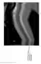 Fig. 11 - HUMAN TYPE I TASTE RECEPTOR SUBUNIT 3 MODULATORS AND METHODS OF USING SAME
