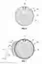 Fig. 05 - INTRAGASTRIC VOLUME OCCUPYING DEVICE WITH ACTIVE AGENTS