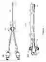 Fig. 02 - High flow catheters