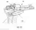Fig. 09 - Bone positioning device and method