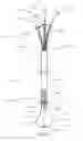 Fig. 02 - Medical kit for constricting tissue or a bodily orifice, for example, a mitral valve