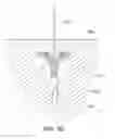 Fig. 07 - Medical kit for constricting tissue or a bodily orifice, for example, a mitral valve