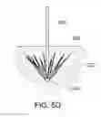 Fig. 08 - Medical kit for constricting tissue or a bodily orifice, for example, a mitral valve