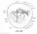 Fig. 45 - Medical kit for constricting tissue or a bodily orifice, for example, a mitral valve