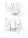 Fig. 03 - Scapholunate stabilization implant