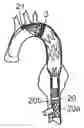 Fig. 01 - Endovascular Grafts and Methods of Use