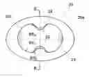 Fig. 01 - Universal disc prosthesis