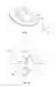 Fig. 02 - Universal disc prosthesis