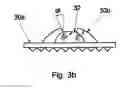 Fig. 08 - Universal disc prosthesis