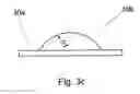 Fig. 09 - Universal disc prosthesis