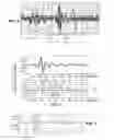 Fig. 03 - Device for adaptive processing of an endocardial acceleration signal