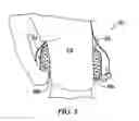 Fig. 05 - Multipurpose Cooling and Trauma Attenuating Devices and Associated Methods