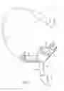 Fig. 02 - Tracheal tube with connector insert