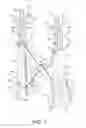 Fig. 02 - Bag supporting apparatus