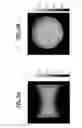 Fig. 15 - Method and apparatus for reduction of specific absorption rate (SAR) in magnetic resonance data acquisition