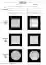 Fig. 19 - Method and apparatus for reduction of specific absorption rate (SAR) in magnetic resonance data acquisition