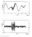 Fig. 02 - METHOD FOR DETECTING A MALFUNCTION OF A SENSOR FOR MEASURING AN ANALYTE CONCENTRATION IN VIVO
