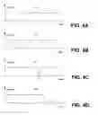 Fig. 05 - INTERACTIVE INPUT SYSTEM AND METHOD
