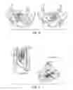 Fig. 03 - Selective hand occlusion over virtual projections onto physical surfaces using skeletal tracking