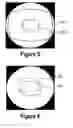 Fig. 05 - Superresolution enhancment of peripheral regions in nonlinear lens geometries