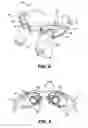 Fig. 06 - Magnification device and assembly