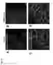 Fig. 35 - Method for inducing angiogenesis in an infarcted heart by administering a coiled coil chimeric molecule