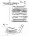 Fig. 16 - Club heads with contoured back faces and methods of manufacturing the same